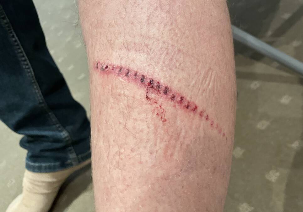Rod's leg was torn open by what he described as a "serrated machete" about 60 centimetres in length. Picture by Jonathan Hawes