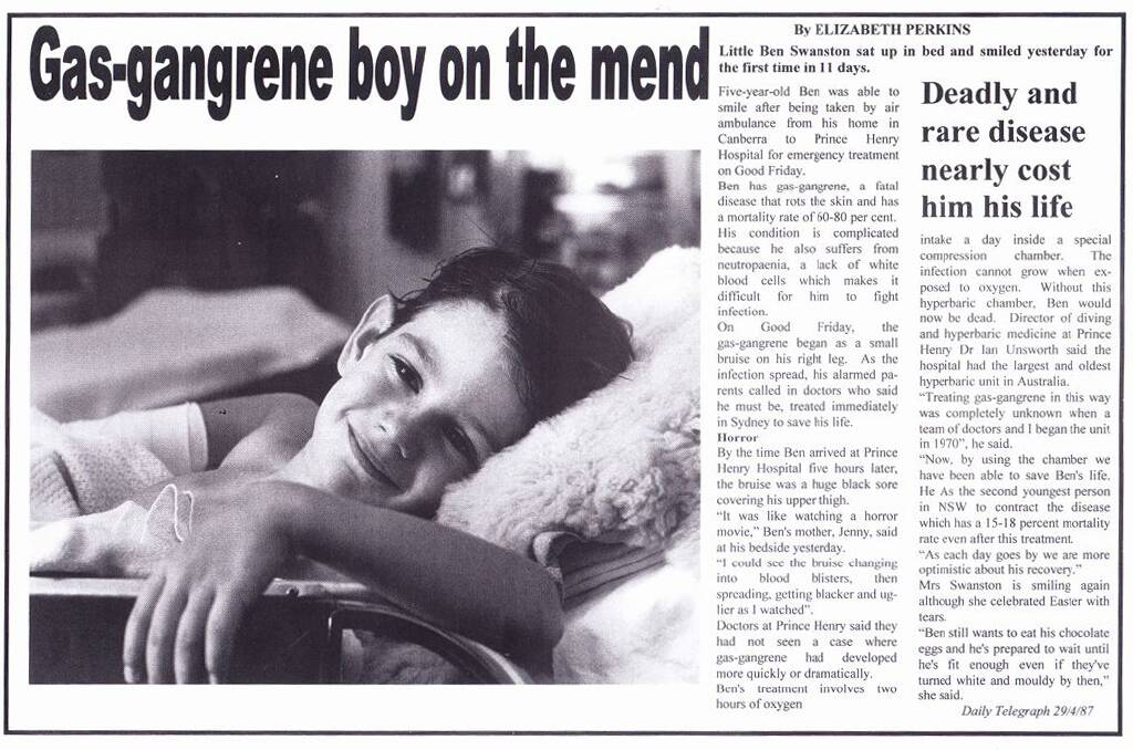 A news clipping from the Daily Telegraph in April 1987 of a boy cured of gas-gangrene by the team at the Hyperbaric unit. Picture supplied. 